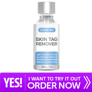 Clear Tag Skin Tag Remover